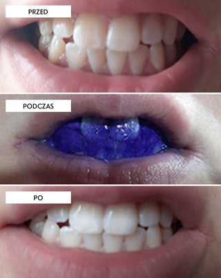 Korektor koloru serum korygujące kolor zębów White Bite Smilebite 30 ml - 3