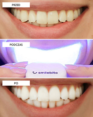 Smilebite Light & Bright Zestaw do wybielania zębów lampa LED + Whitesmile Serum™ - 6