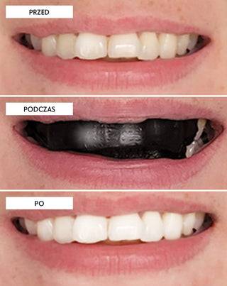 Paski wybielające zęby The White(ning) Stripes Smilebite zestaw 28 szt. - 3