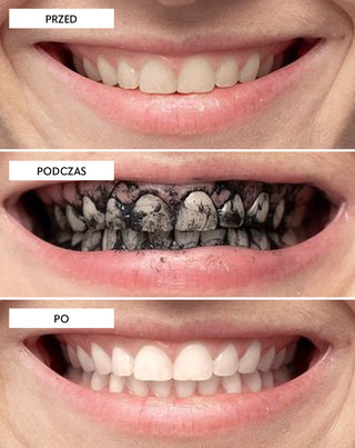 Proszek do wybielania zębów z węglem kokosowym Smilebite - 4